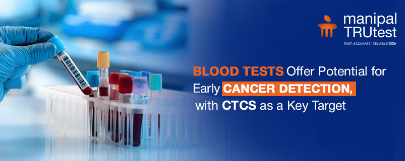 Blood Tests Offer Potential for Early Cancer Detection, with CTCs as a ...
